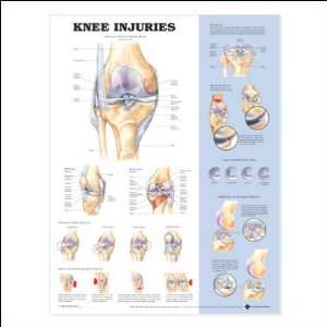  Knee Injuries Anatomical Chart Anatomical Chart 20 X 26 