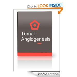 Start reading Tumor Angiogenesis 