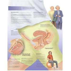 Female Urinary Incontinence Chart  Industrial & Scientific