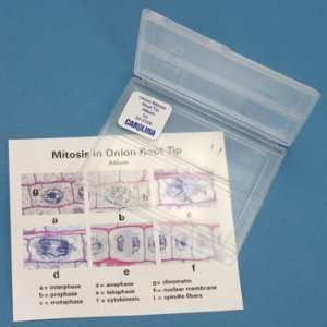 Onion Mitosis Self Study Kit   Microscope Slides  