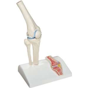 3B Scientific A85/1 Mini Knee Joint Model with Cross Section, 3.9 x 5 