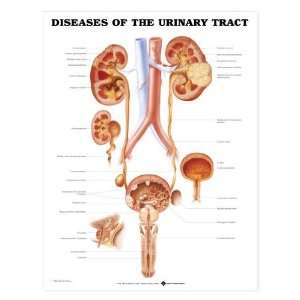  Urinary Tract Diseases Chart Industrial & Scientific